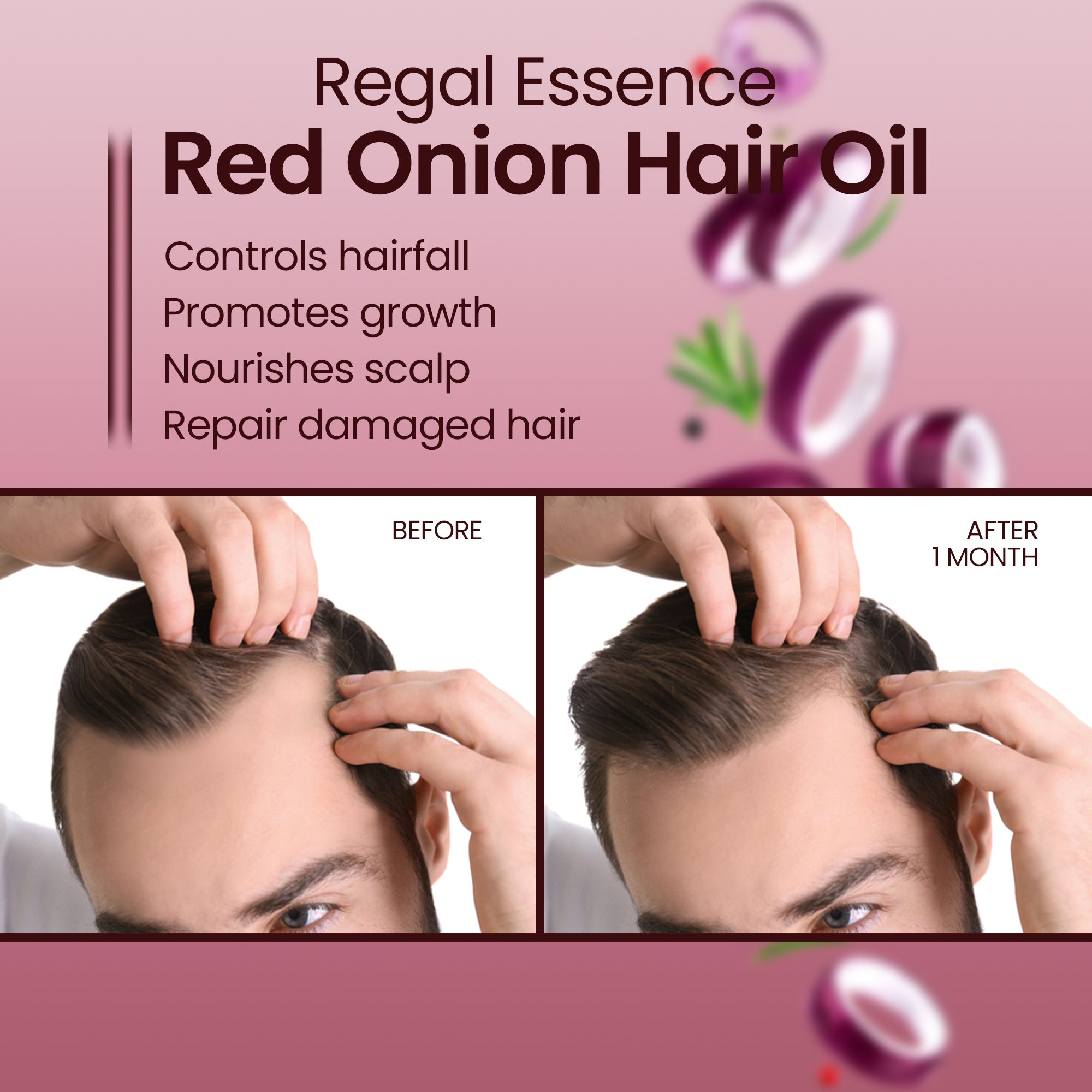 Regal Essence Red Onion Hair Oil For Hair Fall Control & Regrowth-200ml Vedapure Naturals